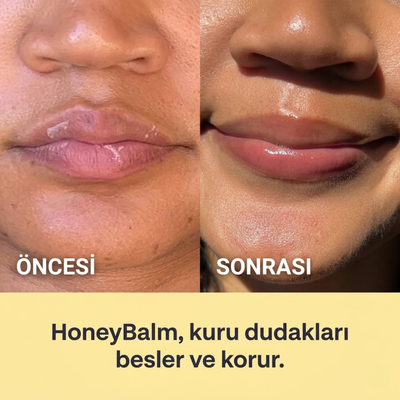 HONEYBALM® Dudak Balmı